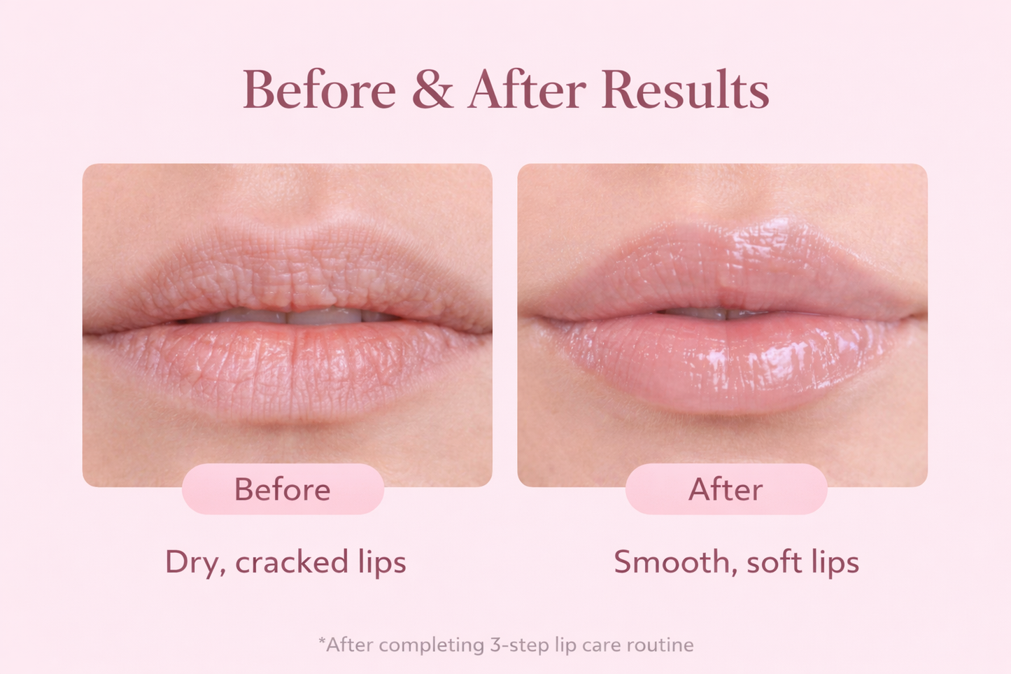 Lip Care Kit — Smooth. Repair. Protect.